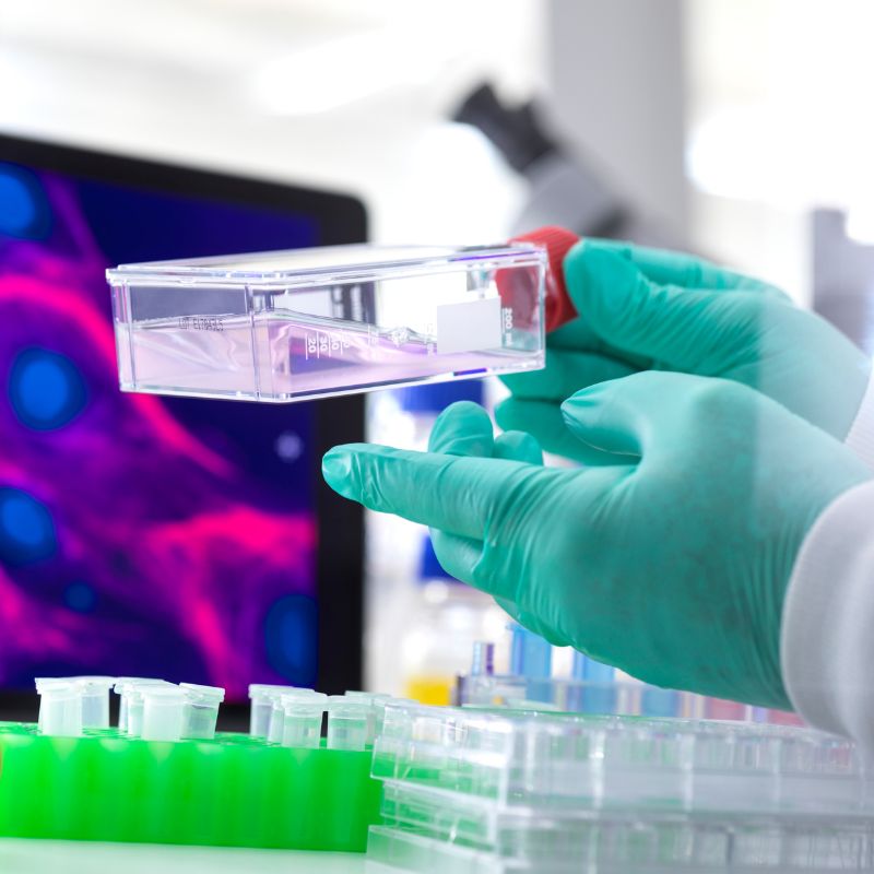 How Stem Cells Can Help Treat Knee Osteoarthritis